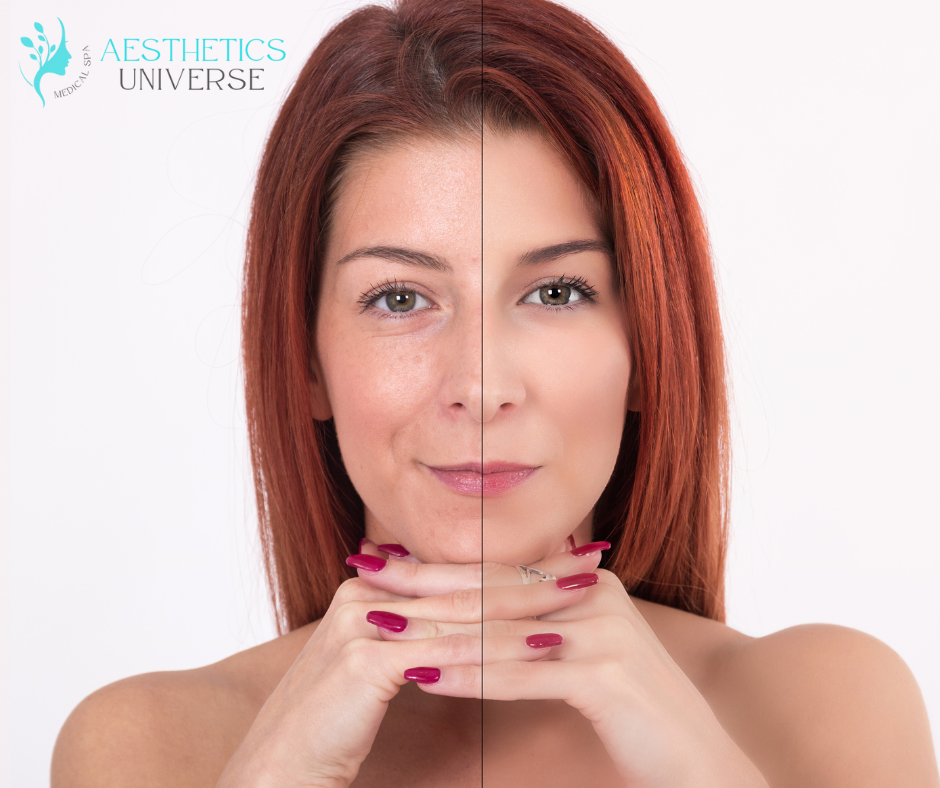 Anaheim Dermal Fillers