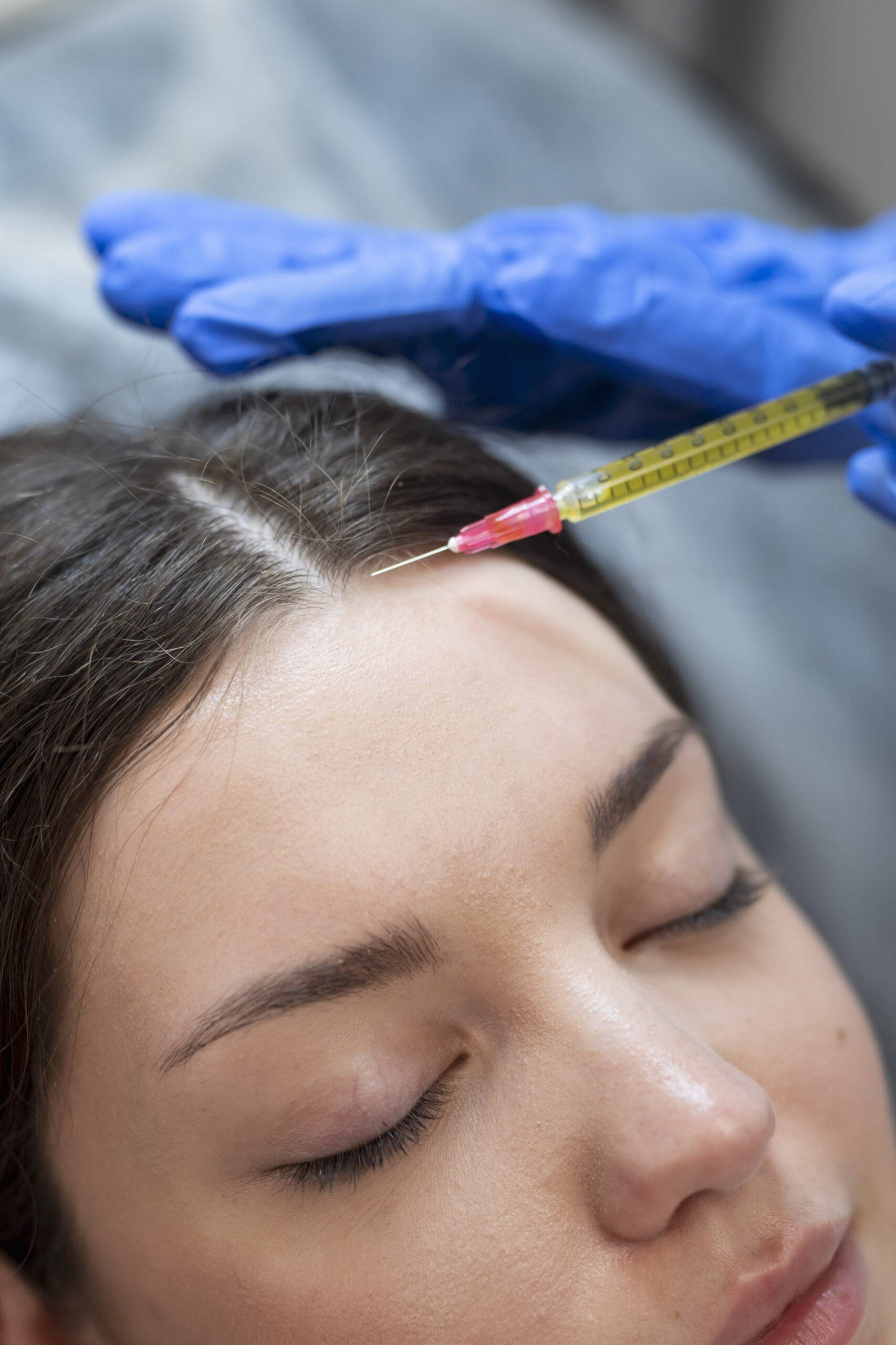 close up young woman getting prp injection scaled